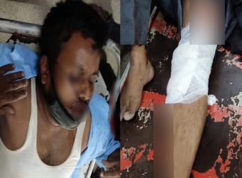ভাড়া নিয়ে তর্ক : বাস থেকে ফেলে দেওয়া হলো শিক্ষককে