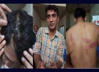 মাদক কারবারিদের হামলায় ৩ মাদকদ্রব্য কর্মকর্তা আহত