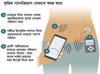 ডায়াবেটিস চিকিৎসায় যুগান্তকারী আবিষ্কার