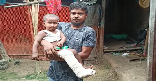  সড়ক দুর্ঘটনায় আহত শিশু সাফিউল, টাকার অভাবে মিলছে না চিকিৎসা 