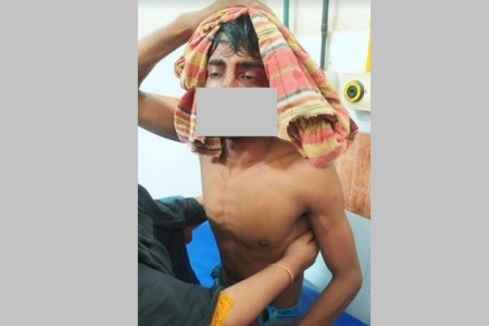স্ত্রীকে কটু কথা বলায় প্রতিবাদ, স্বামীকে হাতুড়ি পেটা