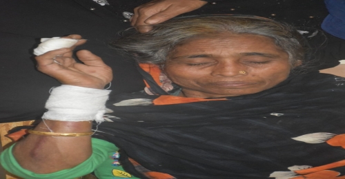 সাতকানিয়ায় জমির বিরোধের জেরে হাত-পা ভাঙ্গল বৃদ্ধার 