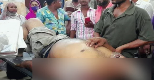 আত্রাইয়ে দুর্বৃত্তদের হামলায় আ.লীগ নেতা আহত