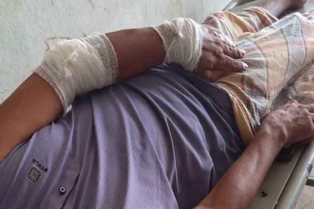 চাঁদা না দেওয়ায় বিএনপি নেতাকে কুপিয়ে জখম  
