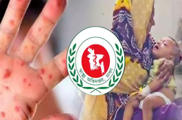 হাম ও উপসর্গে আরও ৪ শিশুর মৃত্যু